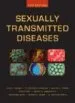 AudioLibro Sexually Transmitted Diseases de King Holmes